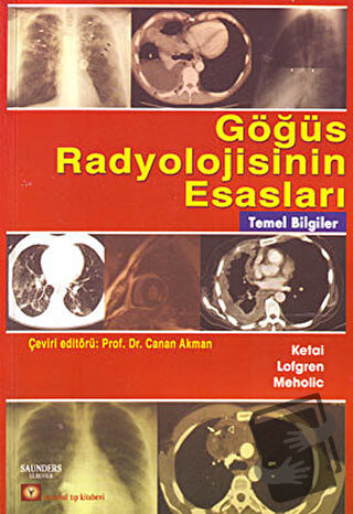 Göğüs Radyolojisinin Esasları - Loren H. Ketai - İstanbul Tıp Kitabevi