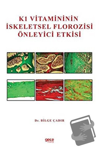 K1 Vitamininin İskeletsel Florozisi Önleyici Etkisi - Bilge Çadır - Ge