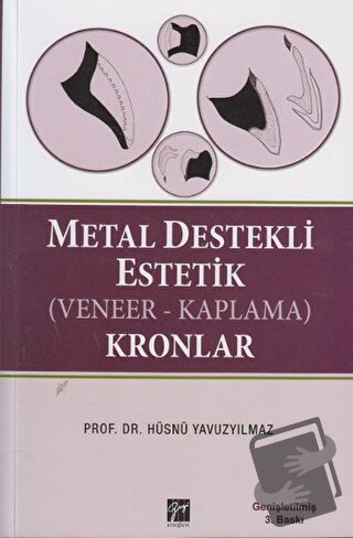 Metal Destekli Estetik (Veneer-Kaplama)Kronlar (Ciltli) - Hüsnü Yavuzy