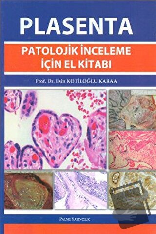 Plasenta Patolojik İnceleme İçin El Kitabı - Esin Kotiloğlu Karaa - Pa