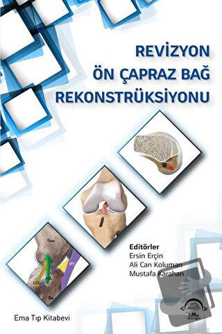 Revizyon Ön Çapraz Bağ Rekonstrüksiyonu - Esin Erçin - EMA Tıp Kitabev